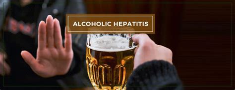 What Are The Symptoms Of Alcoholic Hepatitis Charak