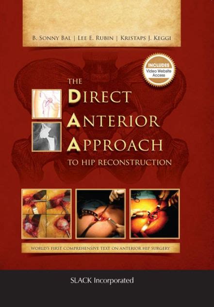 The Direct Anterior Approach To Hip Reconstruction Edition 1 By B