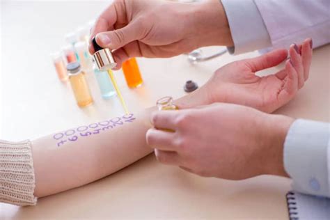 Expect During Allergy Testing What To Expect 4 Big Tips