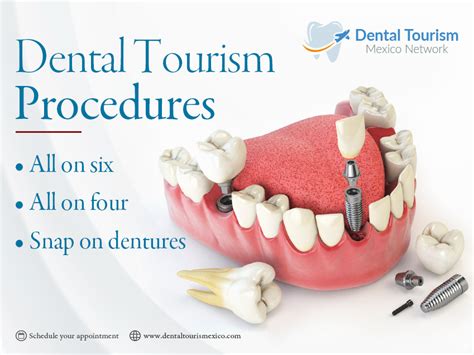 Maybe you would like to learn more about one of these? Extra-large Dental Crowns Before And After Fit #TeethWhiteningPens # ...