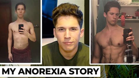 Anorexic Men Before And After