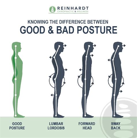 Can A Chiropractor Help With Posture Reinhardt Chiropractic