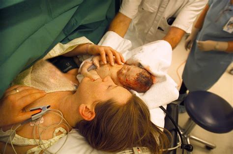 Nach einem kaiserschnitt solltest du mindestens 14 tage mit dem geschlechtsverkehr warten, bis die kaiserschnittnarbe verheilt ist. Set Yourself Up for Breastfeeding Success after Cesarean ...