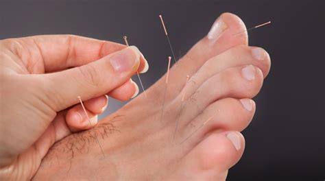 Acupuncture For Diabetes What Are The Benefits