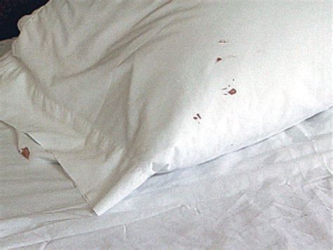 To get rid of bed bugs before they turn into an infestation, call orkin however, evidence of a bed bug infestation may be found in bedding and on mattresses. How Do You Know If Your Have Bed Bugs? 7 Tell Tale Signs