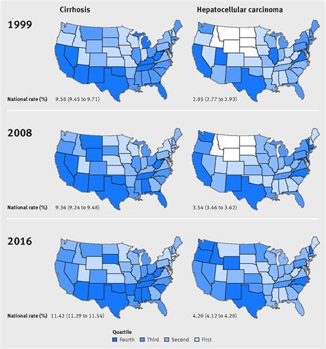 Mortality Due To Cirrhosis And Liver Cancer In The United States 1999
