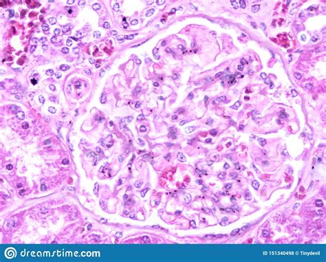 Histology Of Human Liver Tissue Stock Photo Image Of Microscopy