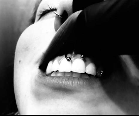 Curious About The Smiley Piercing Read This First