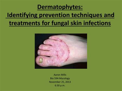Ppt Dermatophytes Identifying Prevention Techniques And Treatments
