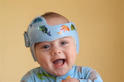 Pediatric Occupational Therapy Tips Plagiocephaly And Torticollis
