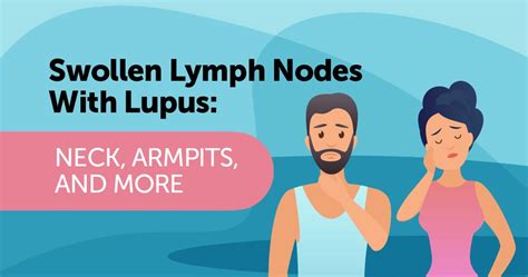 Swollen Lymph Nodes With Lupus Neck Armpits And More Mylupusteam