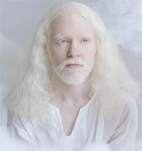 Albinizm Co To Jest Jakie S Przyczyny Albinizmu Jak