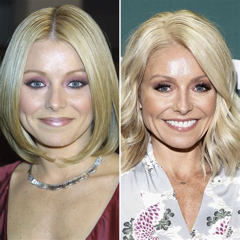 Has Kelly Ripa Had Botox Experts Weigh In