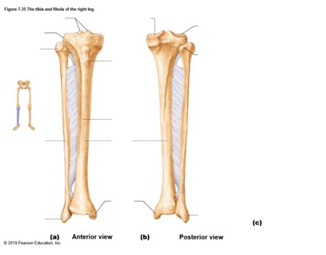 Tibia And Fibula Labeling Posterioranterior Quiz