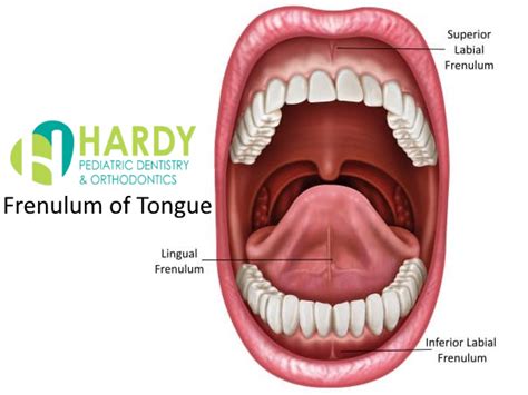 what is frenulum of tongue hardy pediatric dentistry and orthodontics