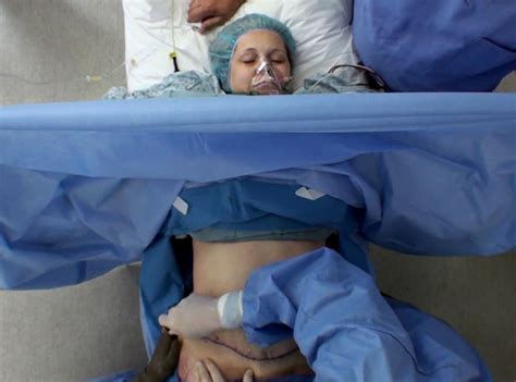 Terrified Patient Stays Awake During Her Tummy Tuck Surgery—see