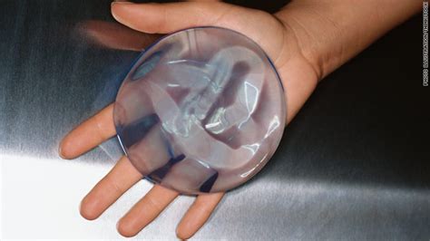 Fda Panels Put Silicone Breast Implants Back Under Microscope