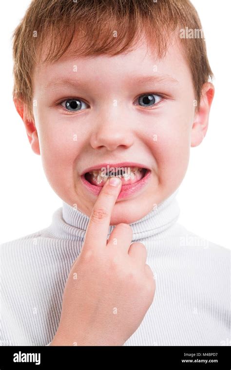 Boy Showing His Missing Milk Teeth Stock Photo Alamy