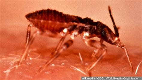Deadly ‘kissing Bug Spreads To More Than Half Of Us Including