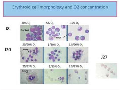 Morphology Of Erythroid Cells At Different Culture Time Points And With