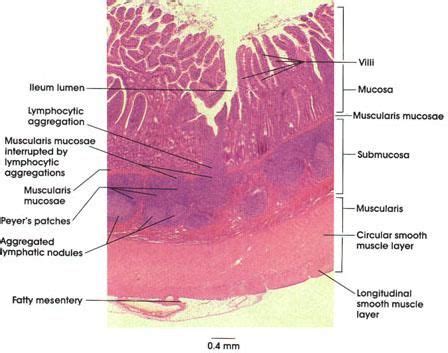 Histological Slides Of The Small Intestine Google Search Anatomy