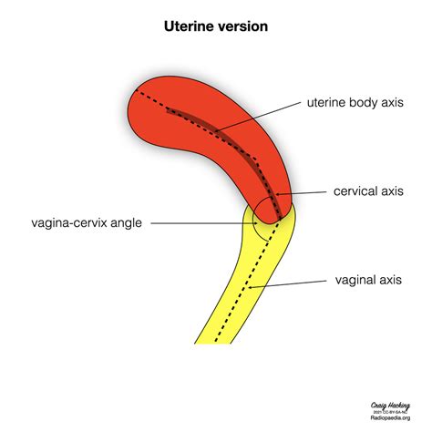 Vagina Cervix Telegraph