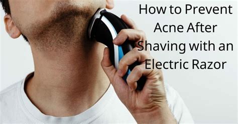 How To Prevent Acne After Shaving With An Electric Razor In 2024