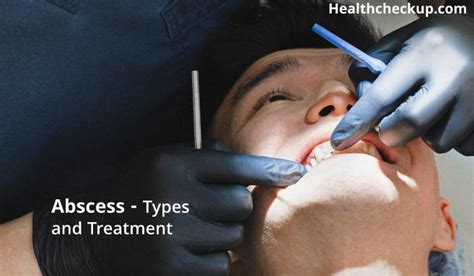 Abscess Types And Treatment Health Checkup