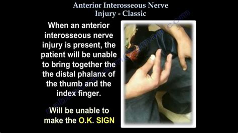 Anterior Interosseous Nerve Injury Classic Everything You Need To
