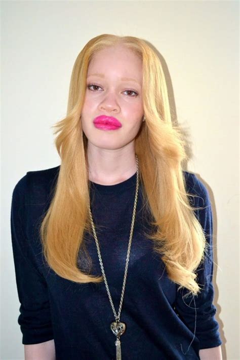 9 Hairstyles Ideas For Albino Women