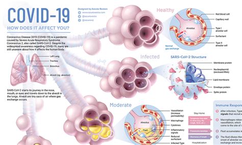 Visualizing What Covid 19 Does To Your Body Visual Capitalist