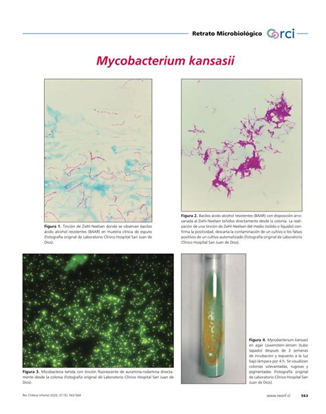 Pdf Mycobacterium Kansasi