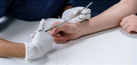 A Guide To The Different Types Of Stitches For Wounds