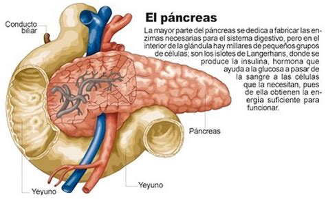 Constituida Por Los Islotes De Langerhans Pancreas Inflamado El