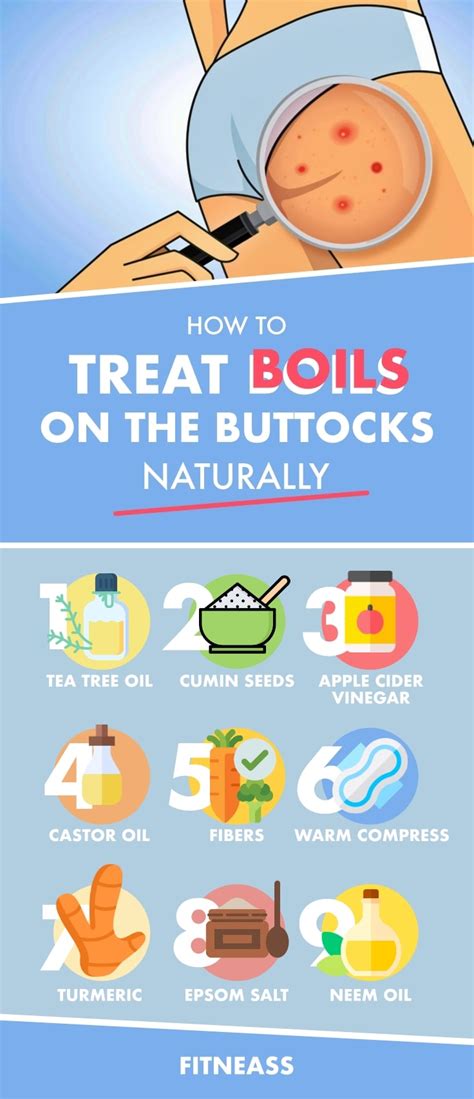How To Treat Boils On The Buttocks With Natural Remedies Fitneass
