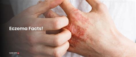 Itching And Pruritus Causes And Treatments Skin Care Itching Or