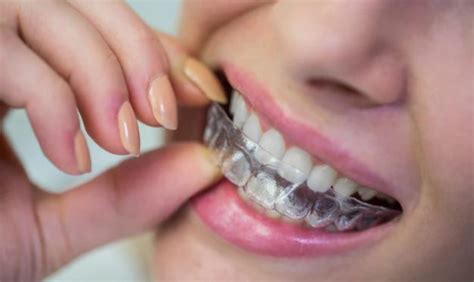 How To Maintain Your Invisalign Aligners