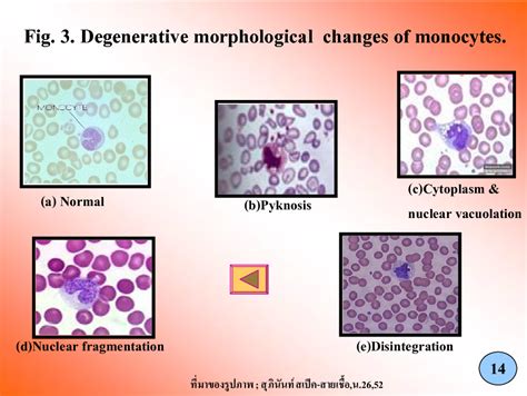 Comparison Of Morphological Changes In White Blood Cells After Death