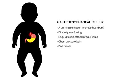 Gerd And Reflux In Babies Causes Symptoms And Treatment By Dr