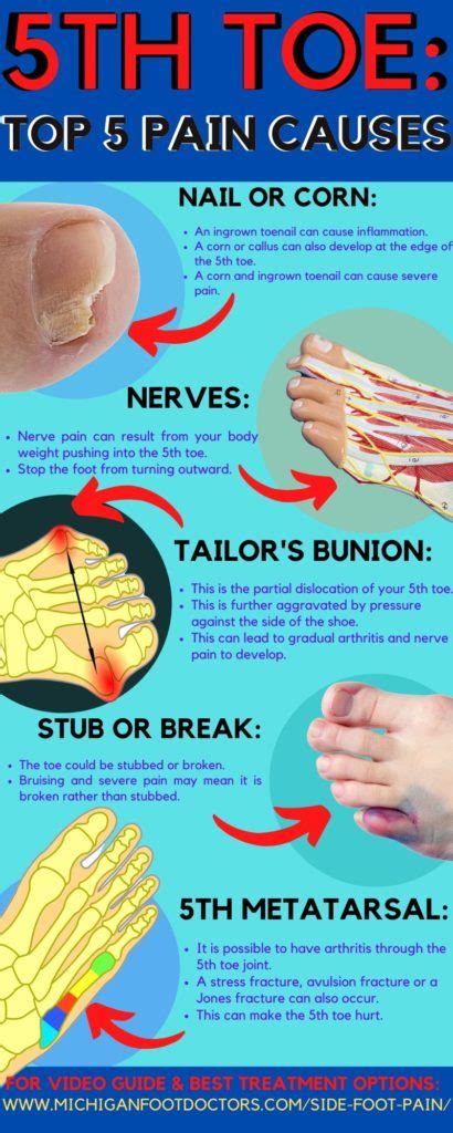 Sharp And Shooting Pain In The Little Toe Causes And Best Treatment