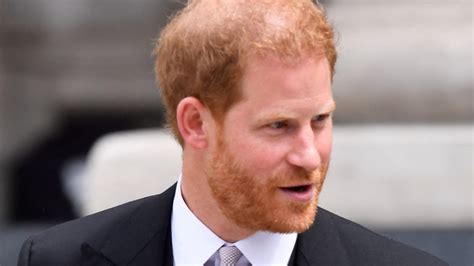 Receding Prince Harry Will Be Completely Bald By Age 40 Hair