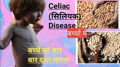 Celiac Disease In Kids Sign And Symptoms Of Celiac Disease Youtube