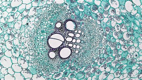 Herbaceous Dicot Stem Bicollateral Vascular Bundle In Cuc Flickr