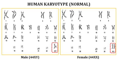 Karyotype Analysis Of Human Chromosome Easybiologyclass