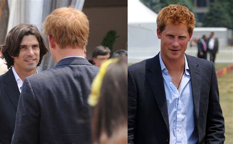 Prince Harry Balding When Did The Royal Start Losing His