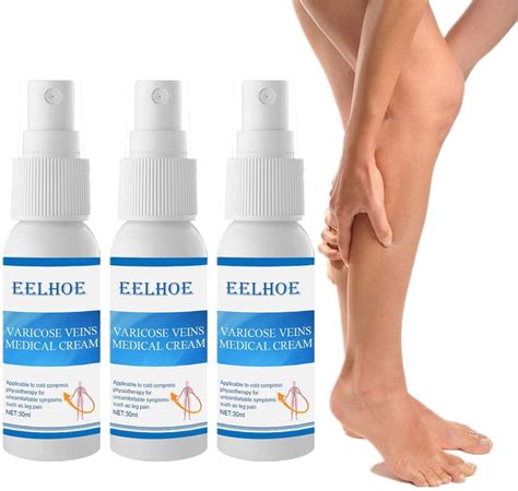 Eelhoe Varicose Veins Relief Cream Vasculitis Phlebitis Spider Medical