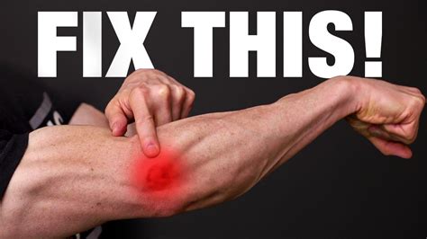 How To Fix Tennis Elbow Permanently Youtube