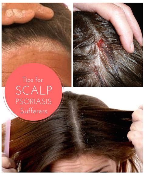 How To Prevent Scalp Irritation From Hair Dye
