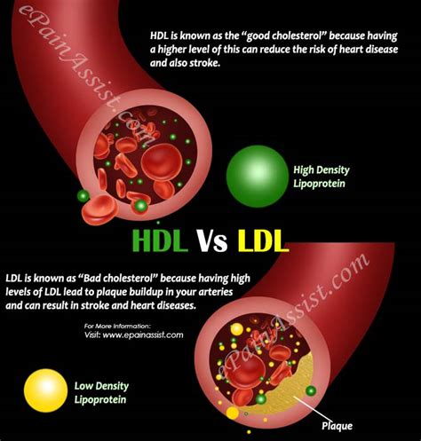 Hdl Vs Ldl Differences Worth Knowing