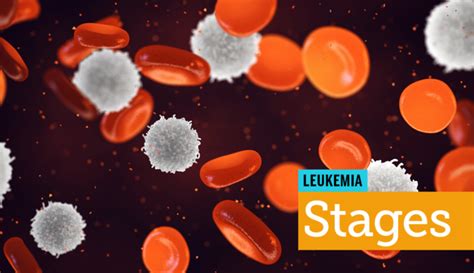Your Guide To Leukemia Symptoms Treatments And More Myleukemiateam